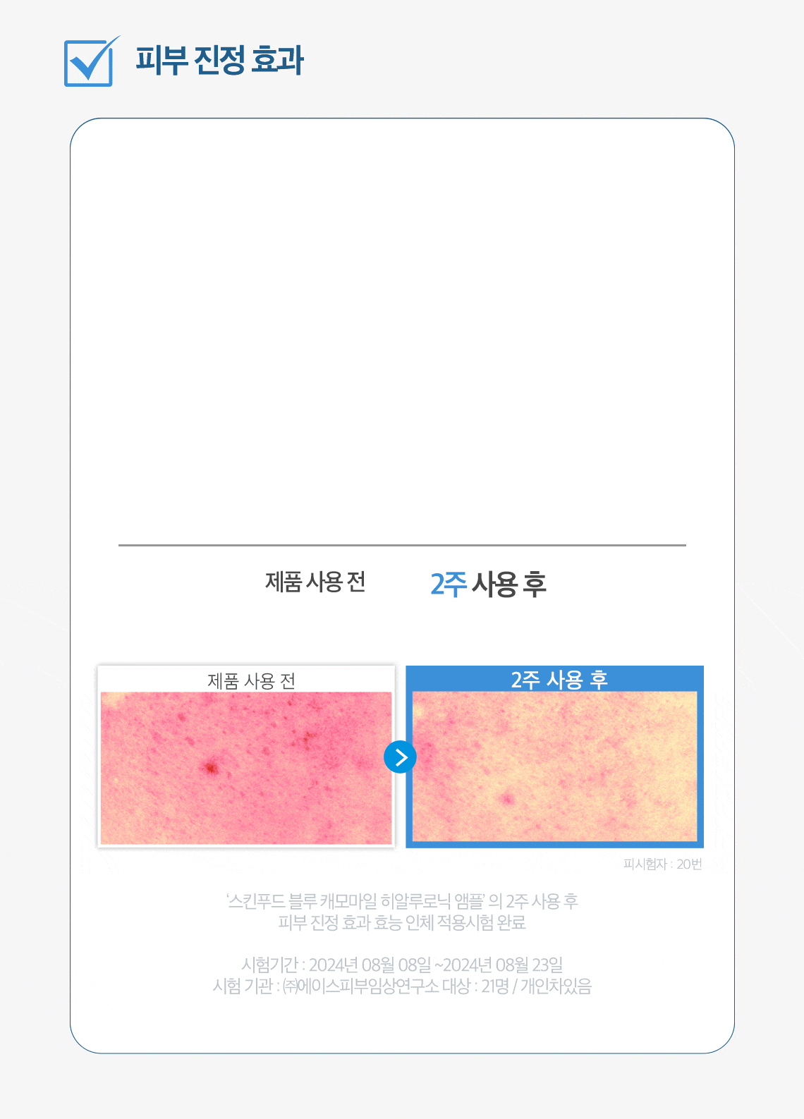 블루캐모마일앰플