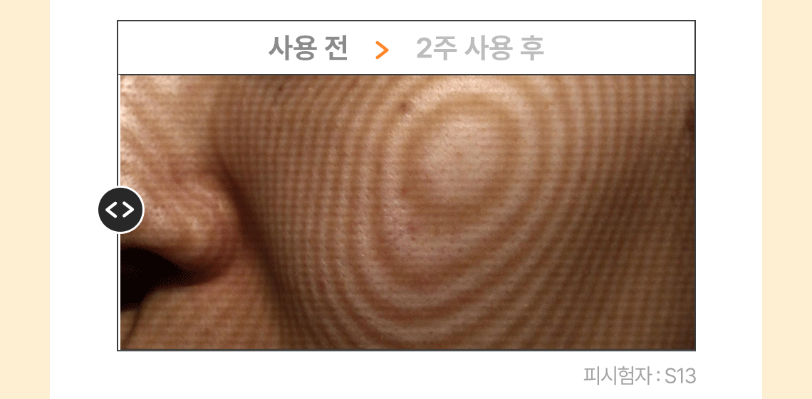 캐롯pdrn패드07_4