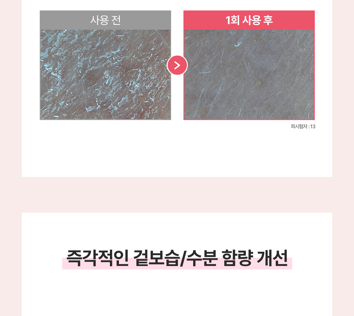 딸기슈가푸드마스크
