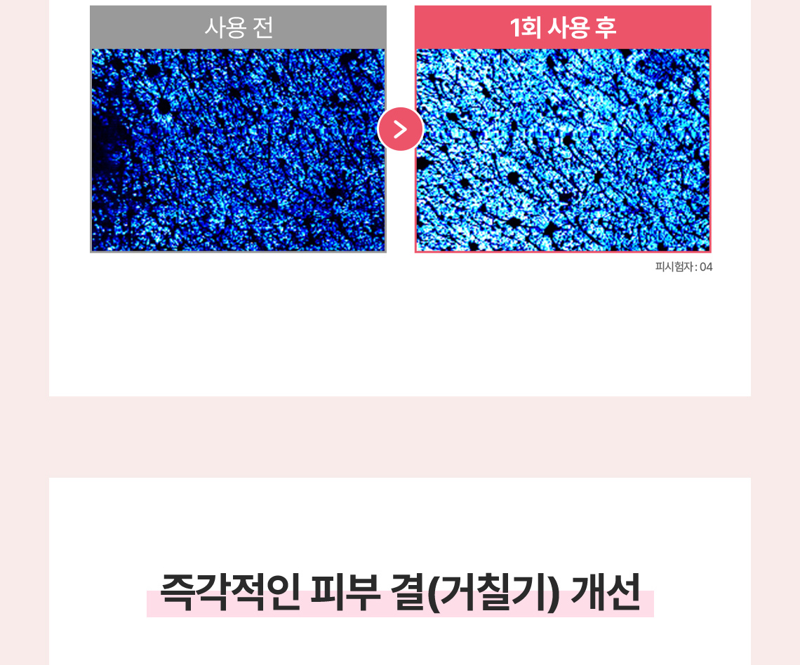 딸기슈가푸드마스크