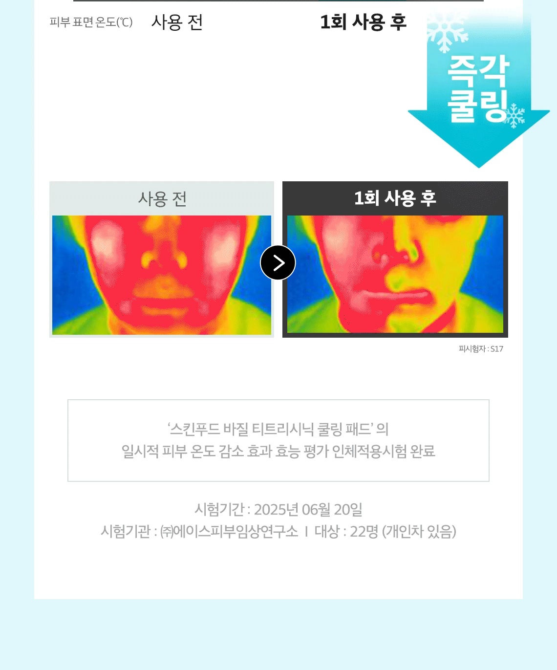 바질티트리 패드 03