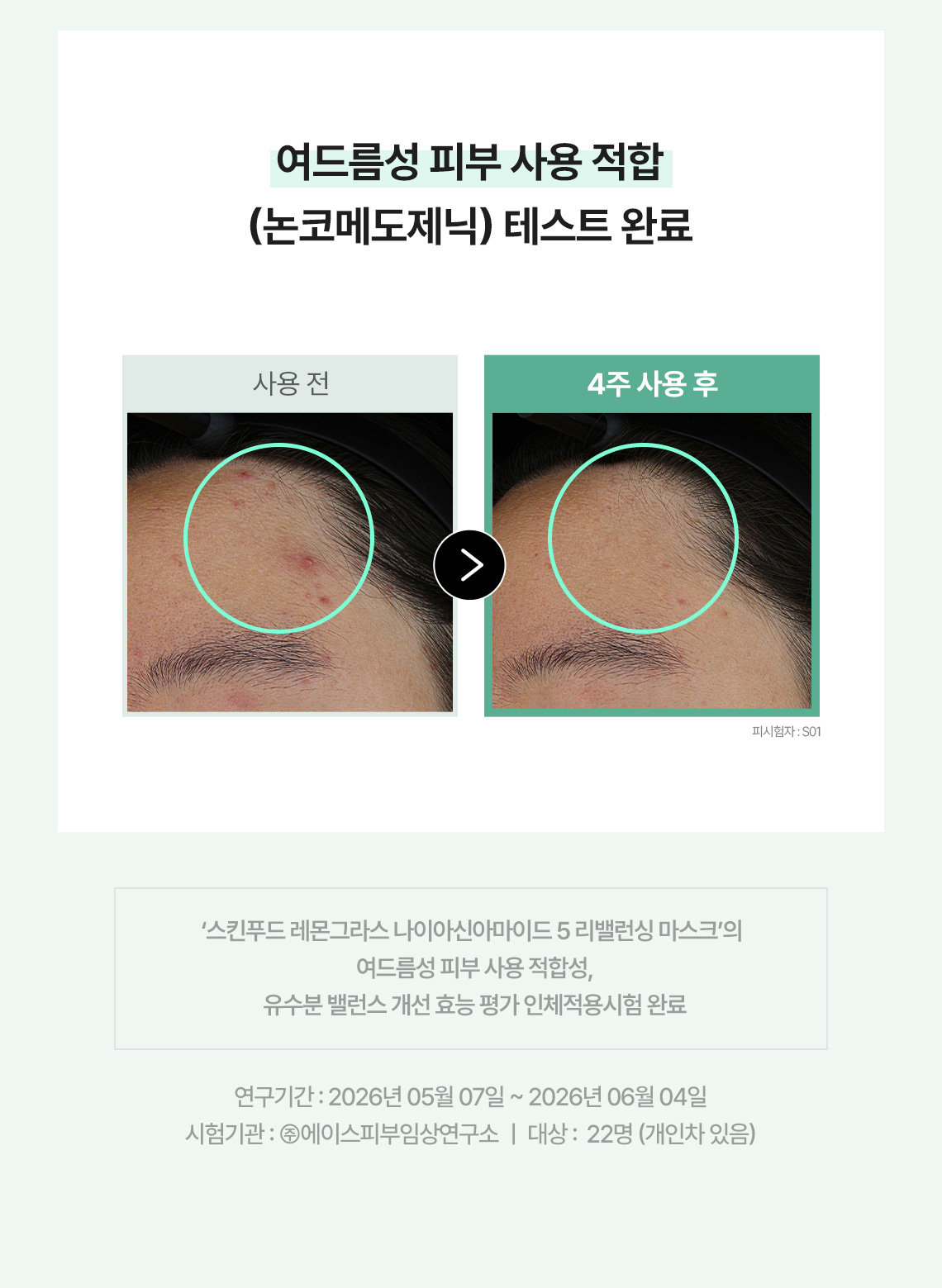 나이아신아마이드 마스크 01